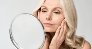 Woman with wrinkles before botox injections in coventry at Apsaras skin clinic