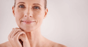 Woman after receiving dermal fillers for anti ageing in Coventry