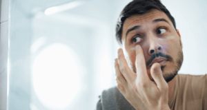 Man doing skincare after receiving dermal fillers in Coventry skin quality